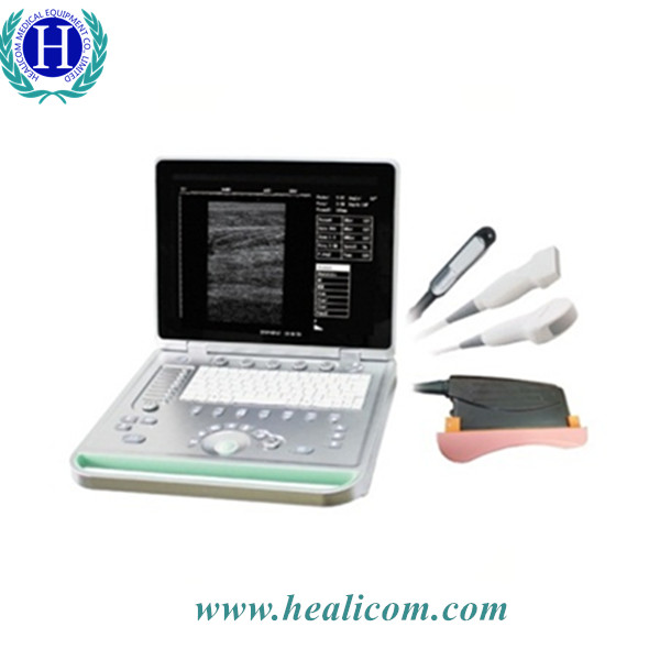 HV-7 Fill Digital B Mode Portable Laptop Medical Veterinary Ultrasound Scanner Diagnostic Vet Ultrasound Machine