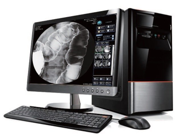 HDF-6000 High Frequency Digital X Ray Equipment