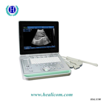HV-9 Full Digital B/W Handheld Palm Veterinary Ultrasound Scanner Portable Vet Ultrasound