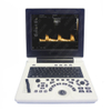 HBW-6P Full Digital Laptop B/W Ultrasound Scanner