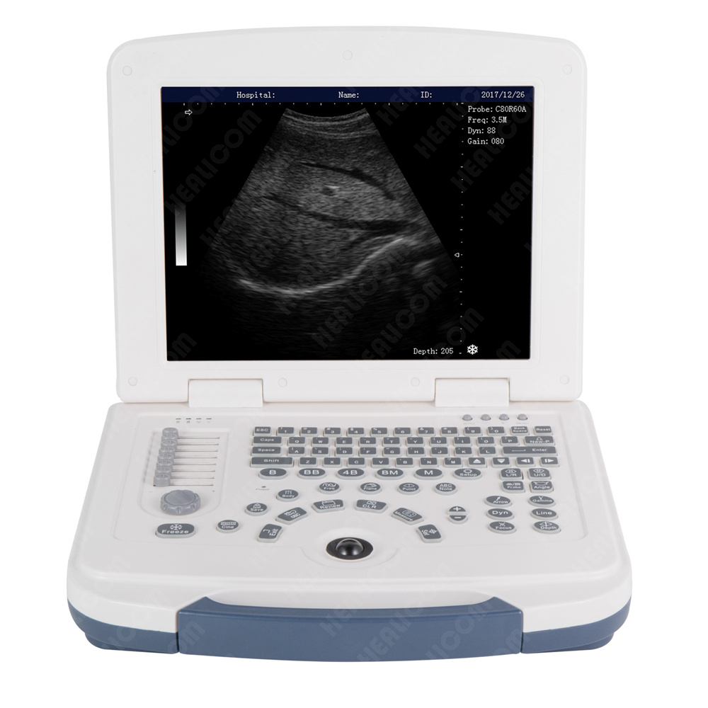 HBW-4 Full Digital Laptop B/W Ultrasound Scanner
