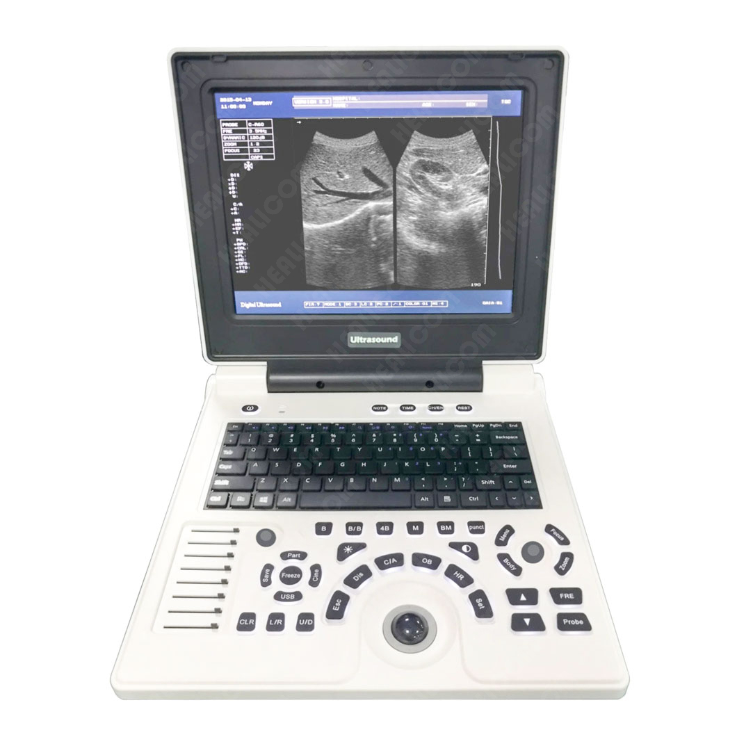 HBW-6 Full Digital Laptop B/W Ultrasound Scanner